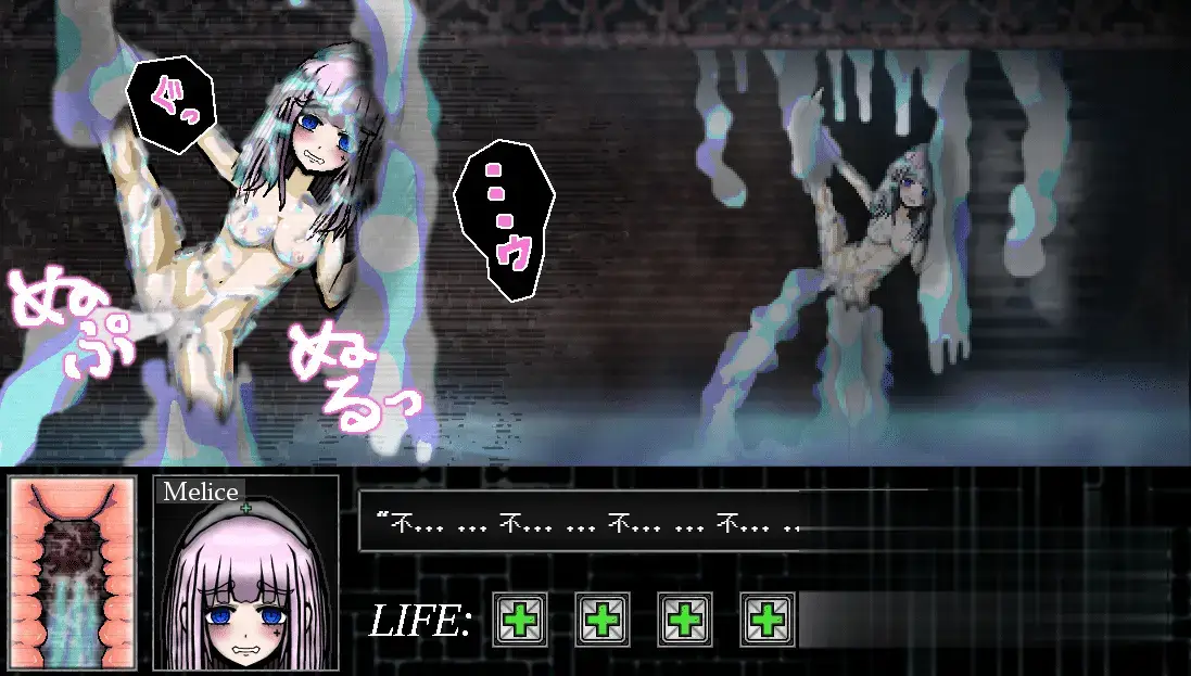 R1530 【SLG/汉化/全动态】异形病栋 異形病棟 PC+安卓精翻汉化版付攻略【1.2G】