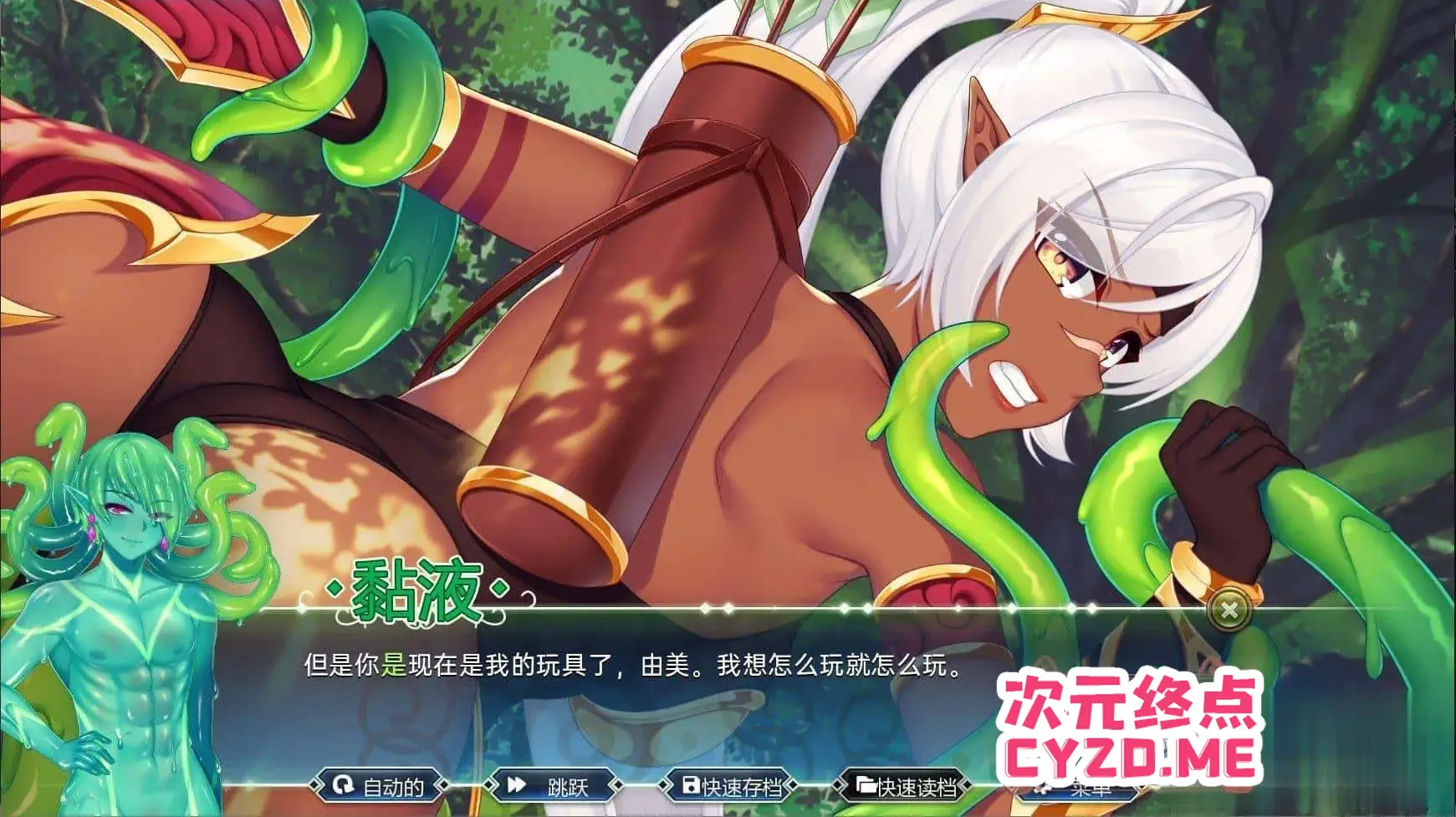 cyzd