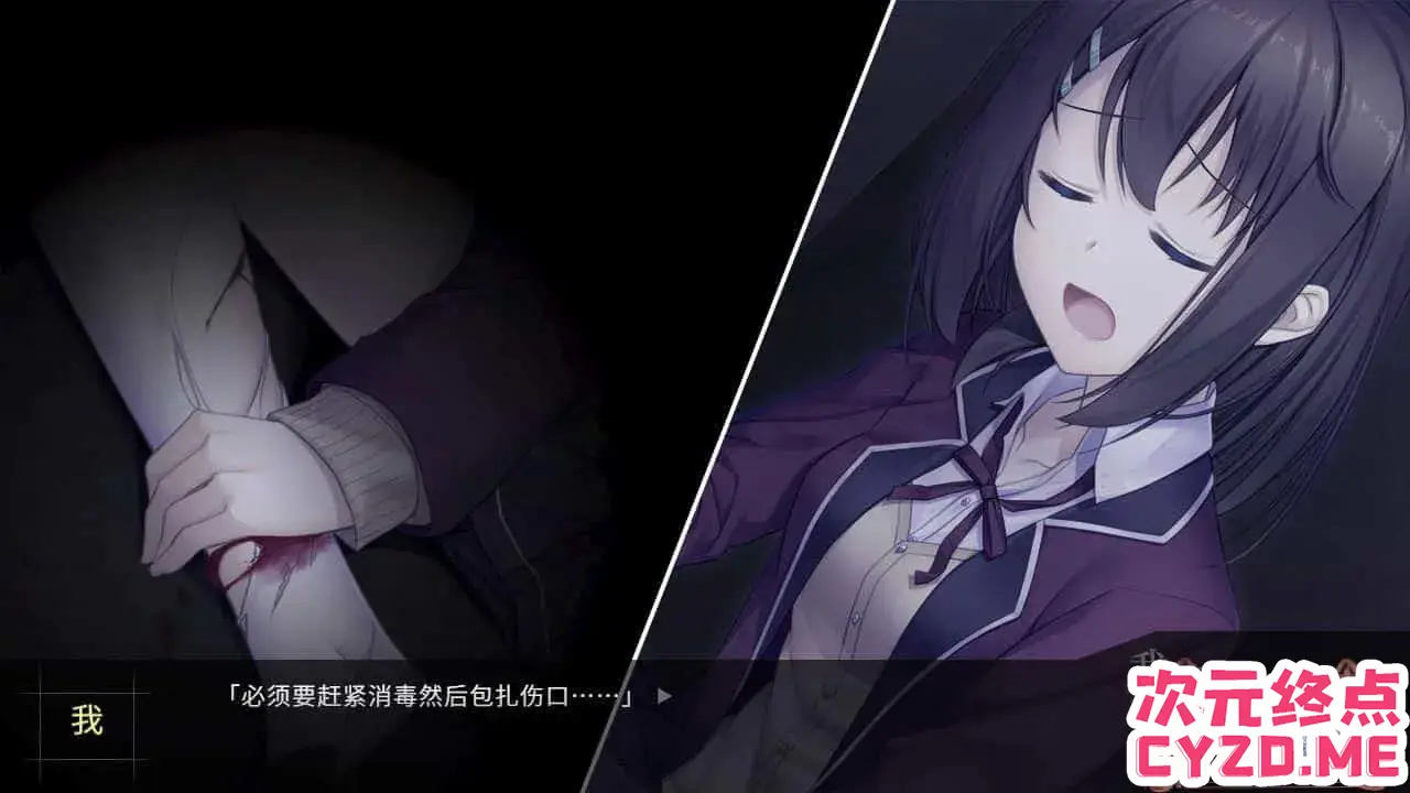 cyzd