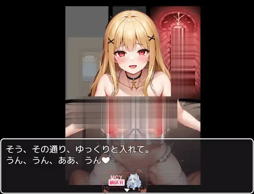 cyzd