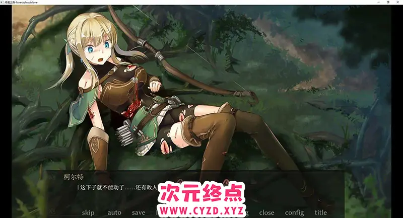cyzd